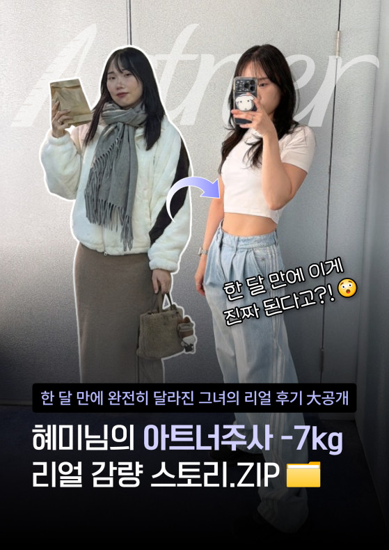 아트너주사 한달 -7kg 리얼 스토리