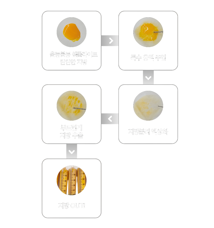 지방 분해
